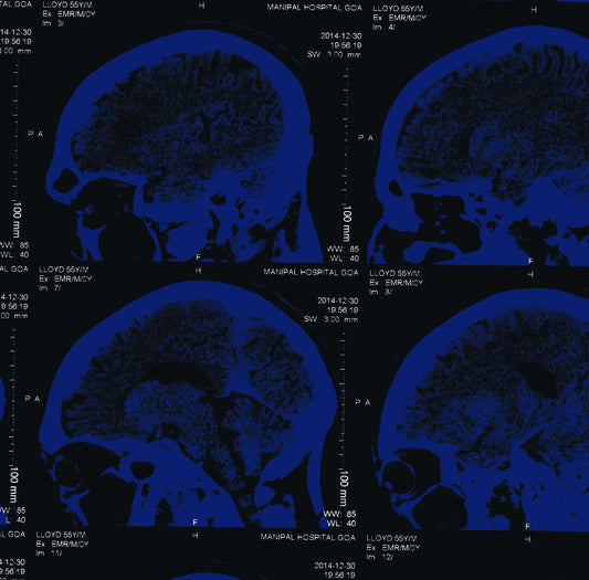 The Nightingales - Mind Over Matter-Vinyl LP-South